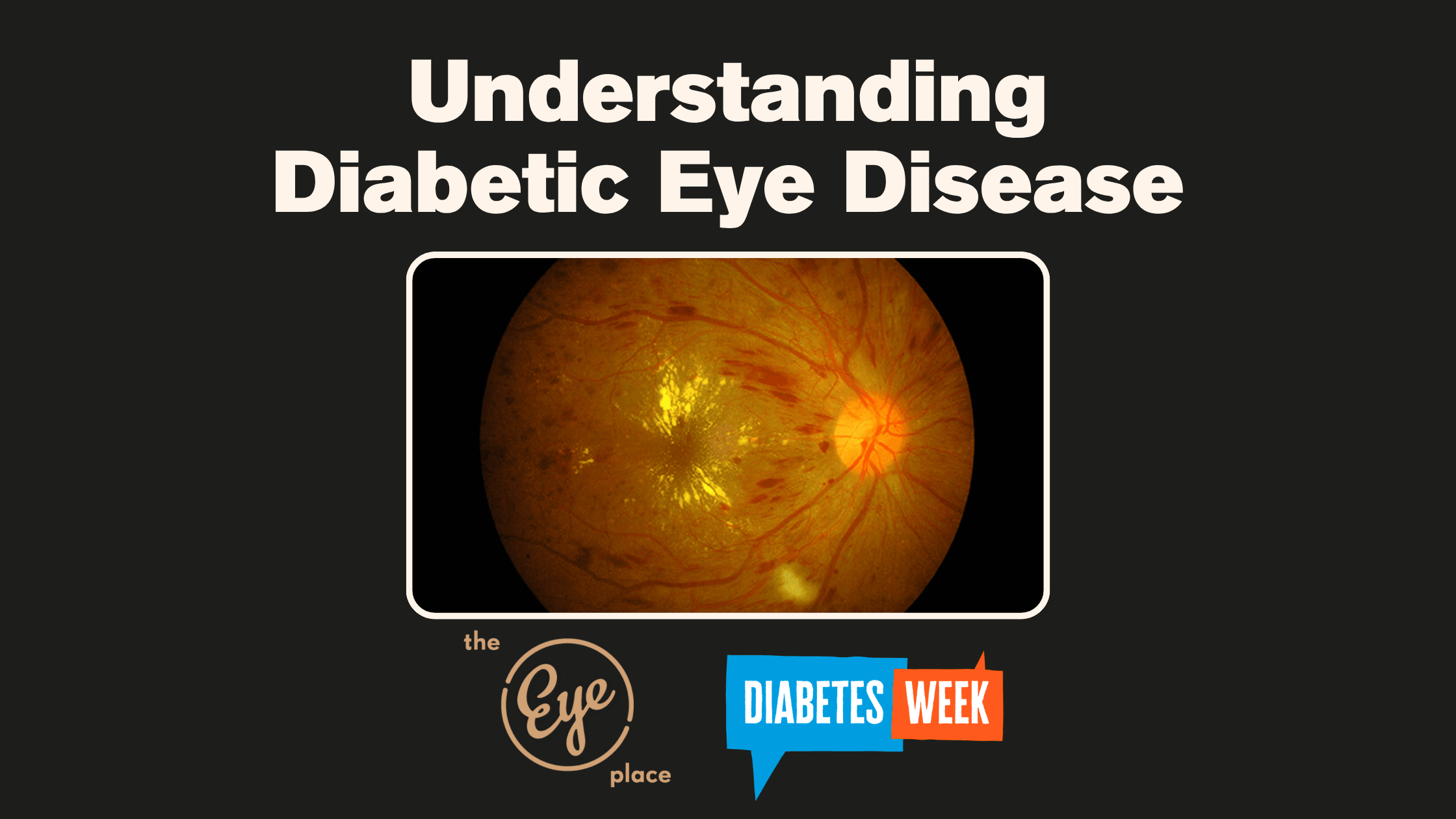 Understanding Diabetic Eye Disease.png